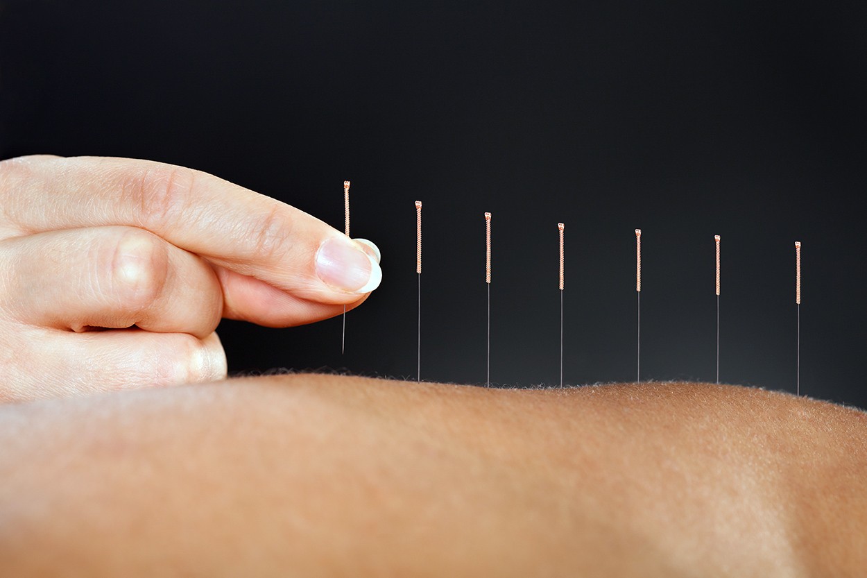 Highland Hospital Is Now Offering Acupuncture Therapy Canopy Health
